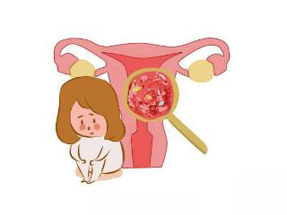得了子宫肌瘤，女性身体往往会有6大表现，若你也有，需及时就医