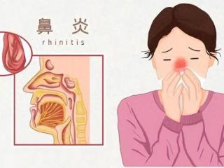 为何夏季过敏性鼻炎频发？如何预防与缓解夏季过敏性鼻炎？