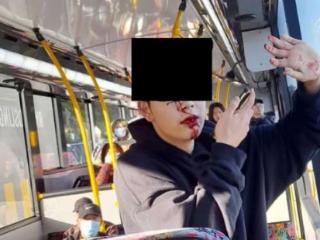 中国留学生在新西兰被打掉牙，称已不敢坐公交！目击者发声