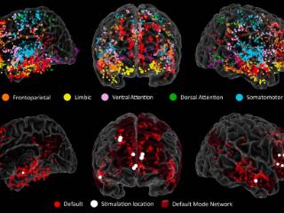 神经科学家精确地指出了大脑创造力的起源