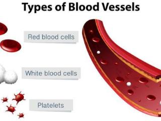 高血脂也许“偏爱”四类人，若你是，请趁早改正，益于血管健康