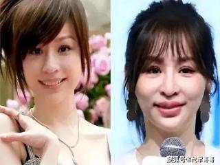 整容上瘾的6位女星，有人“换头改命”爆红，有人却断送了大好前途