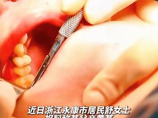 闹大了！男子拔牙23颗种植12颗，手术13天后死亡