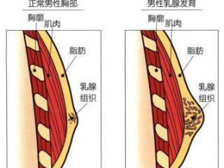 正常男性乳腺组织是不会显著发育的