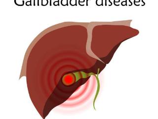 胆囊炎影响生活？提醒患者：想要病情恢复快，这些食物请你别碰！