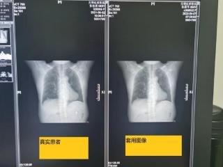 团伙式作案、全链条造假、恶意对抗调查 国家医保局通报无锡虹桥医院调查情况