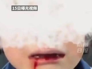 山西一年级女生遭8名同学欺凌，父亲发声不追究，原因曝光