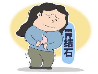 如何避免胃里“长石头”？秋冬季，要格外注意这3种食物→