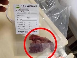 连云港一女子腹痛4年被发现体内有纱布！家属怀疑此前手术遗留，当地：正调查