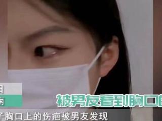 女子胸口烫伤被男友发现，得知原因后当场忍不了摔门离开