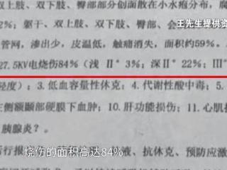 11岁男孩爬火车头遭高压电击！父母崩溃......