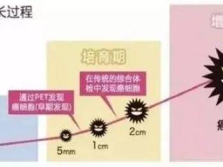 抗癌、抗衰、抗病毒——健康不可缺少的NK免疫细胞！