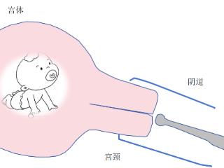 怀孕了，一定要做阴超吗？可以换吗？